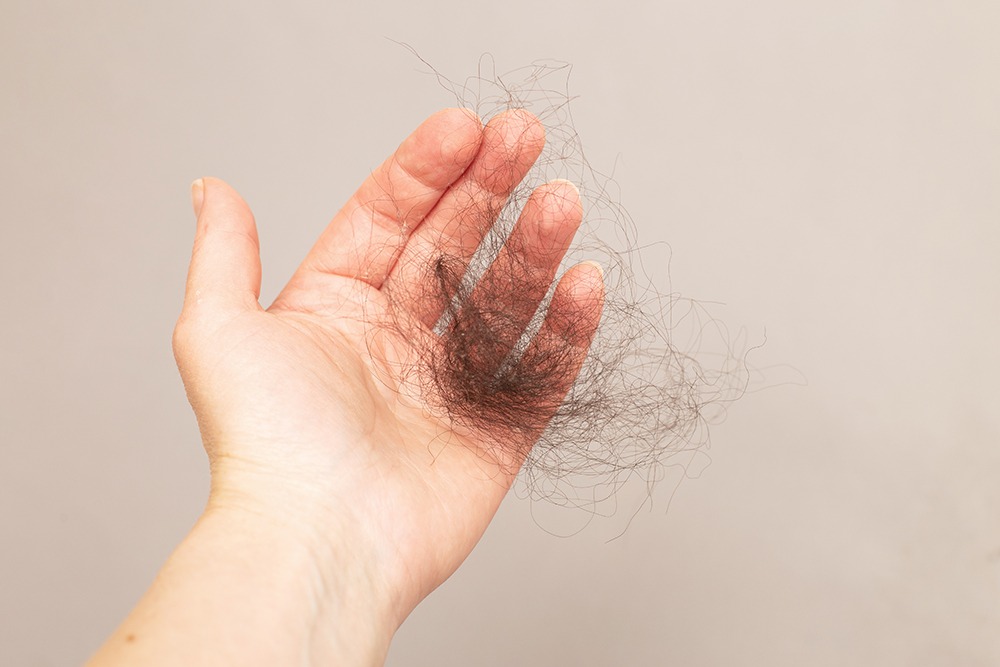 Serenity Emporium Hair Salon Cheadle hairloss3